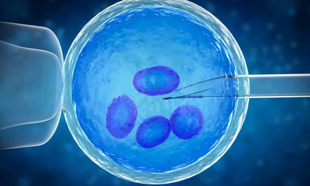 תְמוּנָה
